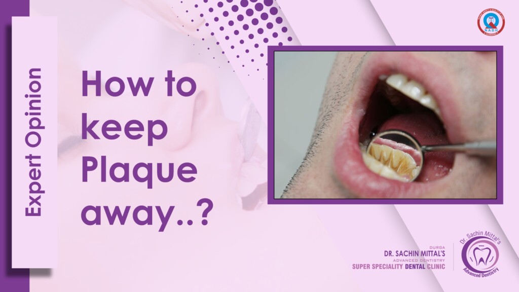 Expert Opinion How to keep plaquExpert Opinion How to keep plaque away from Teethe away from Teeth