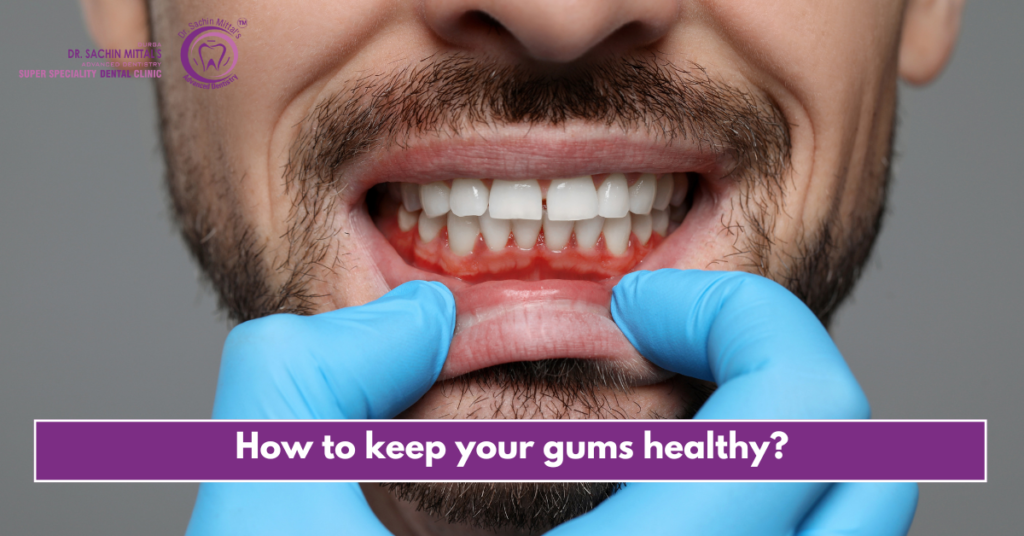 How to keep your gums healthy?