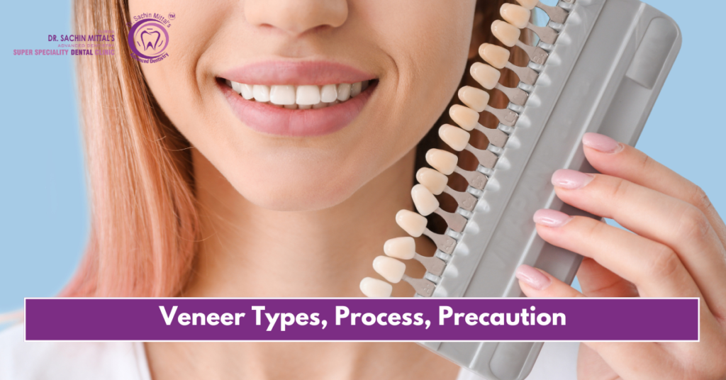 Veneer Types, Process, Precaution