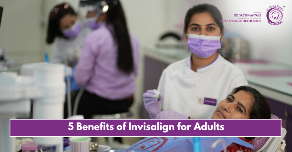 5 Benefits of Invisalign for Adults