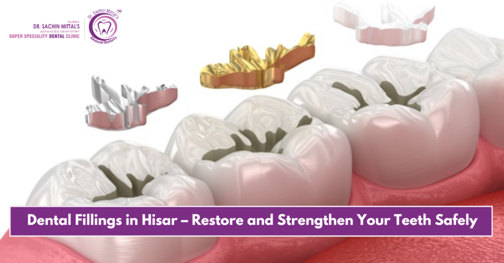 Dental Fillings in Hisar – Restore and Strengthen Your Teeth Safely