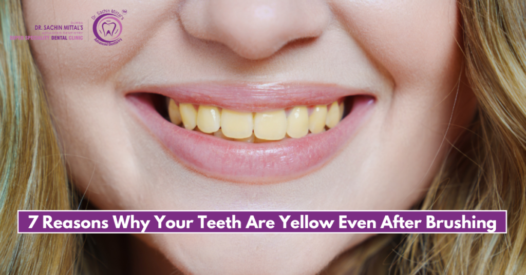 7 Reasons Why Your Teeth Are Yellow Even After Brushing