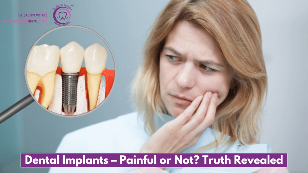 Dental Implants – Painful or Not? Truth Revealed