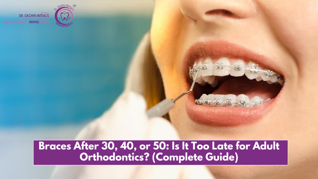 Braces After 30, 40, or 50: Is It Too Late for Adult Orthodontics? (Complete Guide)