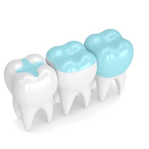 Why Do Teeth Become Sensitive? Powerful Causes & Proven Treatments
